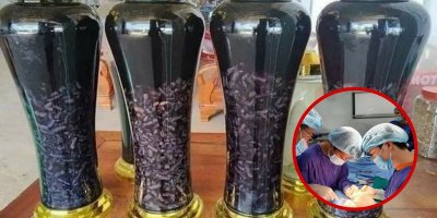 Người đàn ông bị "cương" trong suốt 30 giờ, phải nhập viện cấp cứu
