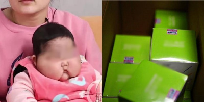 Trung Quốc: Kem dưỡng da trẻ em bị thu hồi vì nghi gây ra “to đầu”
