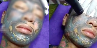 Thanh niên xăm kín mặt quyết định xóa xăm "làm lại cuộc đời"
