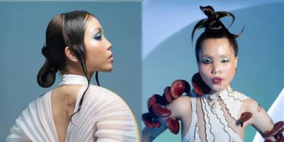 Cô gái bị chồng sắp cưới tạt axit xuất hiện lạ lẫm ở bộ ảnh nghệ thuật
