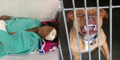 Từ vụ chó Pitbull cắn người ở Long An: "Liệu có nên cấm nuôi chó dữ"