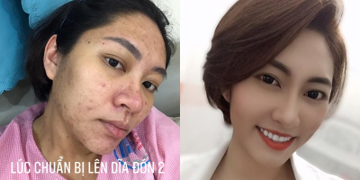 Xuống sắc khi mang thai, Đặng Thu Thảo thay đổi sau vài tháng sinh con