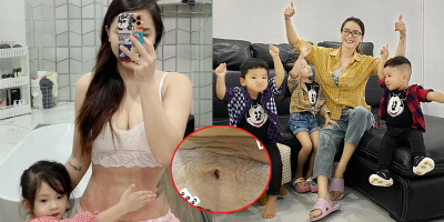 Hải Băng tự tin khoe những vết rạn sau 3 lần sinh