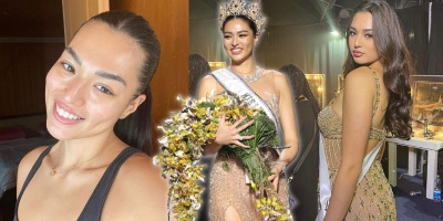 Từng bị mụn nặng, Hoa hậu "ngoại cỡ" Thái Lan trân trọng làn da hơn