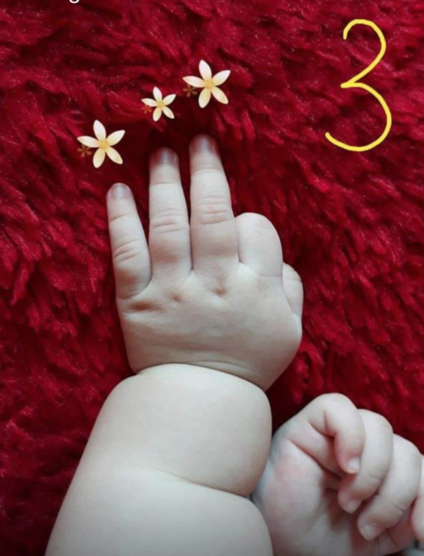 Tay chân em bé đáng yêu và phát triển là một trong những điều thu hút khiến bố mẹ thăng hoa. Bấm vào ảnh để ngắm các chi tiết nhỏ xinh của đôi chân, đôi tay nhỏ bé của con bạn nhé!