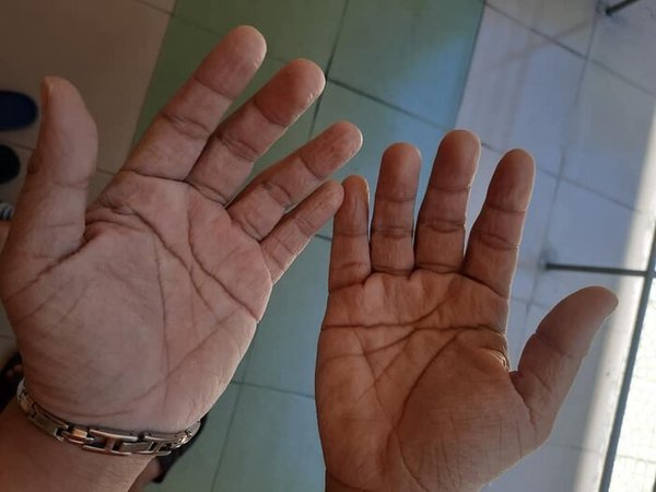  
Đôi bàn tay của một y bác sĩ. (Ảnh: Saostar)