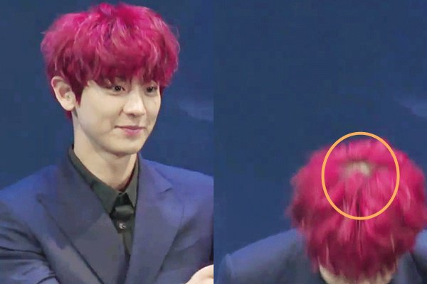  
Chanyeol (EXO) lộ phần tóc hói khi cúi chào khán giả. Nam thần tượng cũng phải tẩy tóc thường xuyên để duy trì "mái đầu" hồng nổi bật của mình. (Ảnh: T.H)