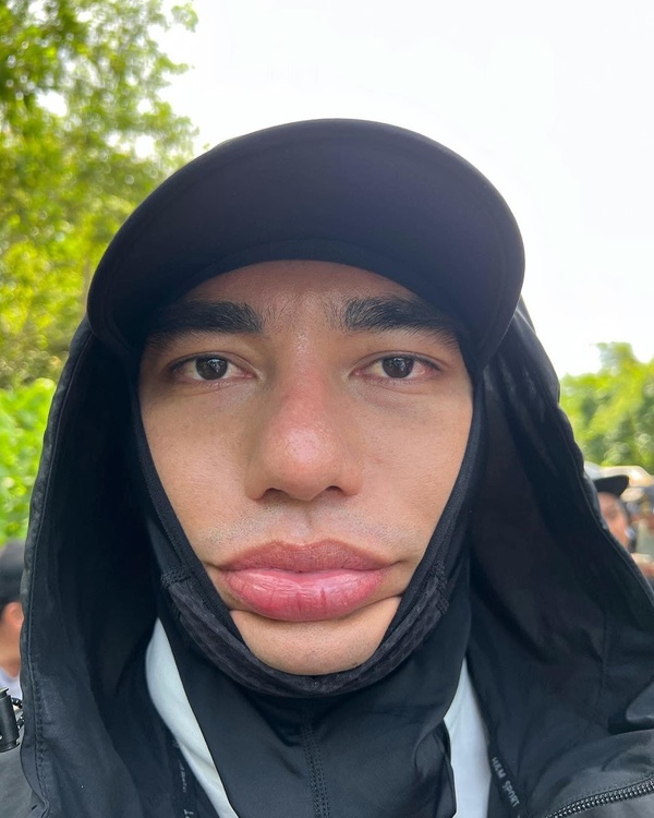  
Lê Dương Bảo Lâm không ngại khoe đặc điểm “thương hiệu”. (Ảnh: FB Lê Dương Bảo Lâm) - Tin sao Viet - Tin tuc sao Viet - Scandal sao Viet - Tin tuc cua Sao - Tin cua Sao