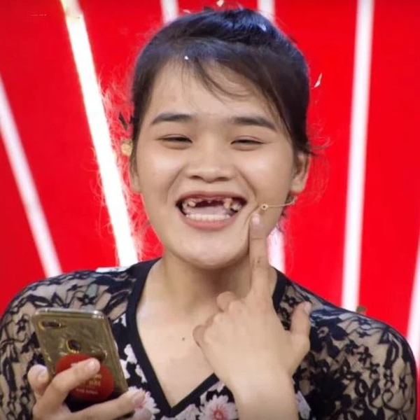 Cô gái nghèo khuyết 9 chiếc răng đã trở thành tâm điểm chú ý của cộng đồng mạng với hài hước sún răng của mình. Hãy xem hình ảnh liên quan để thấy rõ sự duyên dáng và đáng yêu của cô gái này đúng không nào? Chắc chắn bạn sẽ cười \