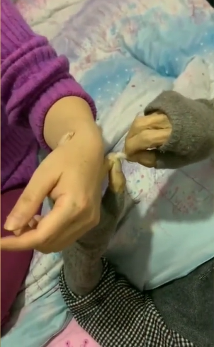 
Đôi tay gầy gò của ông đang cố gắng châm cứu, điều trị bệnh cho con. (Ảnh: Weibo)