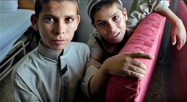
Ba anh em Abdul Rasheed đã được chữa trị và sống cuộc sống như bao đứa trẻ khác. (Ảnh: Internet)