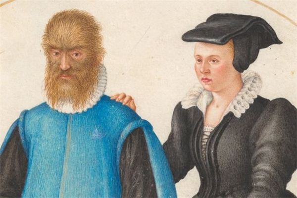 
Người đàn ông “quái vật” Petrus Gonsalvus cùng cô dâu Catherine của mình. (Ảnh: National Gallery of Art)