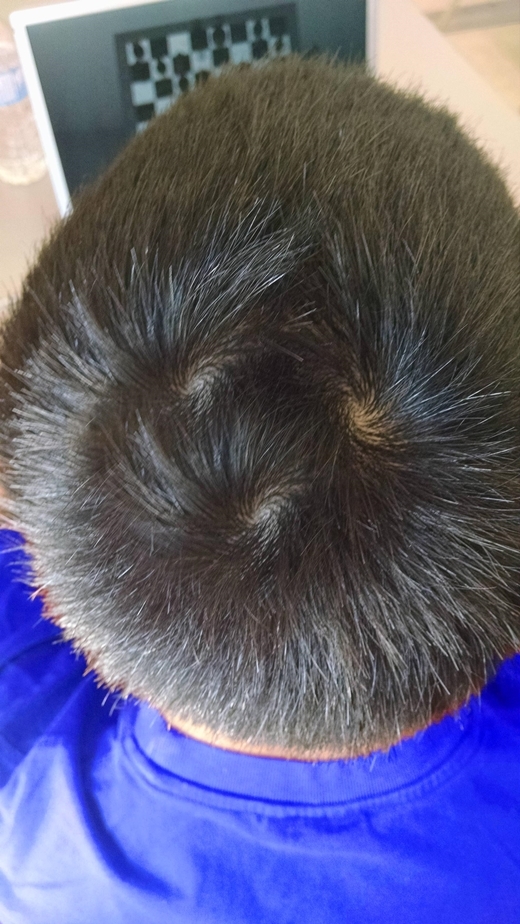 Mẹo khắc phục nhược điểm tóc bò liếm chỉ với vài thao tác  Nhà thuốc FPT  Long Châu