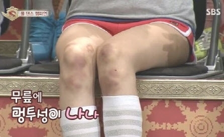
Khi xuất hiện trên show truyền hình, đôi chân đầy những vết thâm kín trên đầu gối của Nana nhìn mà "xót lòng".