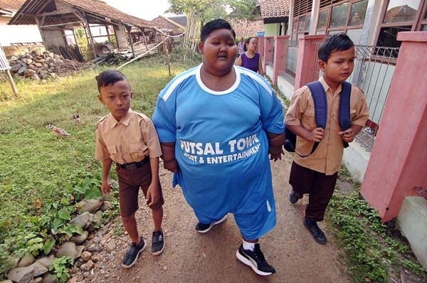 Cậu bé 11 tuổi nặng gần 200kg phải phẫu thuật dạ dày để giảm cân