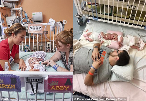 
Hai chị em song sinh Erin và Abby nằm trong nôi với mẹ và một nữ y tá bên cạnh (trái) và nằm bên cạnh bố (phải).