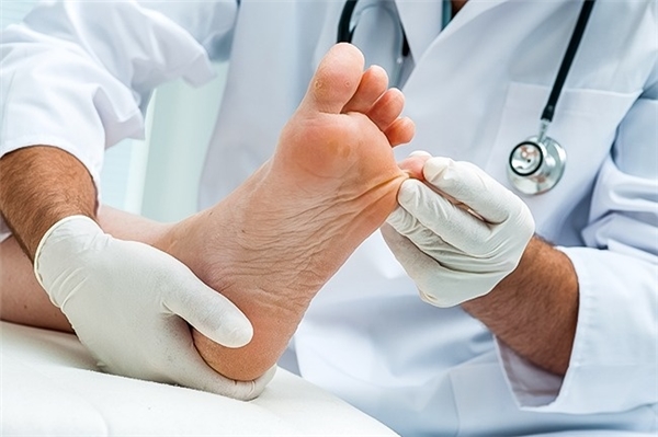 Bạn nên tới gặp bác sĩ để điều trị nếu chân của bạn gặp phải những triệu chứng lạ.