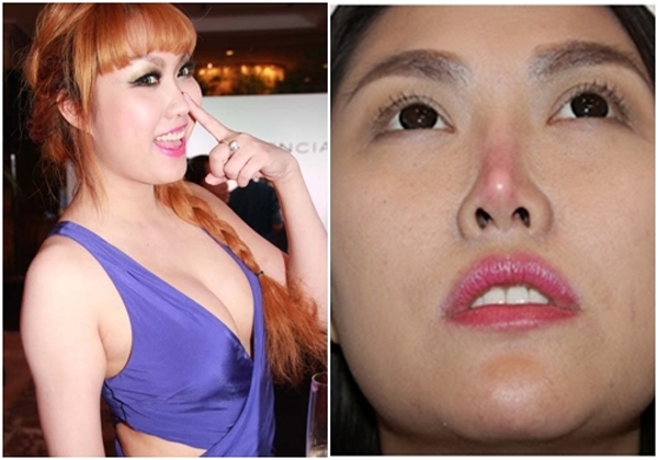 
Năm 2014, khuôn mặt Phi Thanh Vân bắt đầu biến dạng vì phẫu thuật quá nhiều.