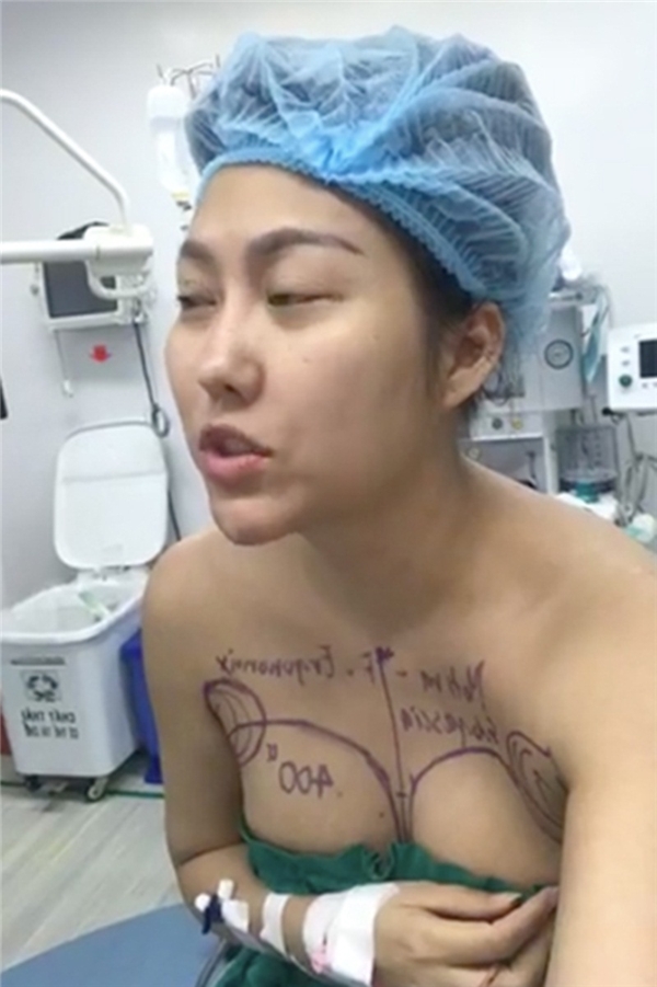 Diện mạo đầu tiên của Phi Thanh Vân sau 43 giờ phẫu thuật thẩm mỹ - Tin sao Viet - Tin tuc sao Viet - Scandal sao Viet - Tin tuc cua Sao - Tin cua Sao