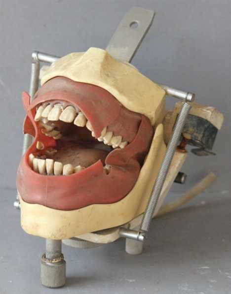 
Và đây là ''series'' răng giả. Tuy nhìn hơi sợ, nhưng hàm răng giả thời ấy cũng đã đáp ứng được nhu cầu của những người “trồng răng”.