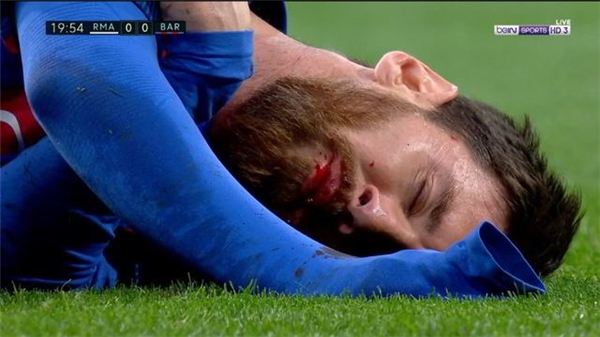 
Messi nằm sân sau pha va chạm với Marcelo trong trận siêu kinh điển.