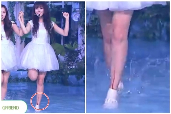 
 Trong sân khấu comeback gần đây, chân Yuju “đổ máu” thành một vệt dài khiến các fan không khỏi “hốt hoảng”.