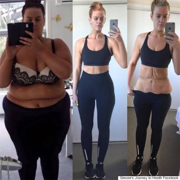 
Giảm béo cật lực từ hàng trăm ký, người phụ nữ liệu có sở hữu thân hình như mong muốn?