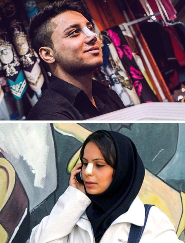 
Người dân Iran luôn phát cuồng vì những chiếc mũi thẳng.