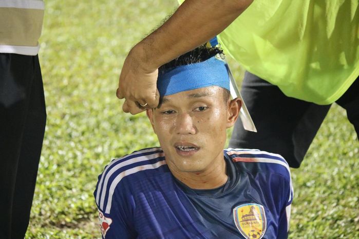 Tiền vệ Phan Thanh Hưng đổ máu sau một pha tranh chấp cuối hiệp 1 (Ảnh: Nguyễn Tin)