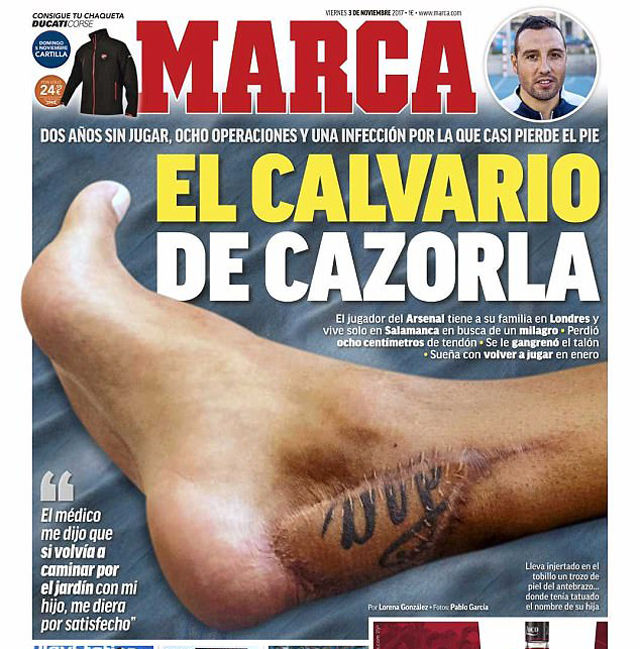 Nổi bật trên bàn chân của Carzola là vết sẹo chạy dài với chi chít những đường khâu.