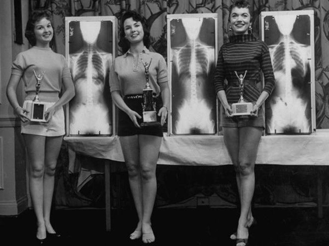 
Các thí sinh chiến thắng đứng bên cạnh hình chụp Xquang cột sống của mình.