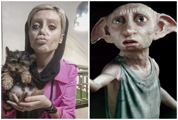 
Sau khi phẫu thuật, gương mặt Tabar​ hao hao gia tinh Dobby trong series phim Harry Potter.