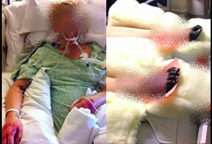  
Hình ảnh của cô trong bệnh viện khi phải đối mặt với nguy cơ sốt cao, đau tim và hoại tử ngón chân