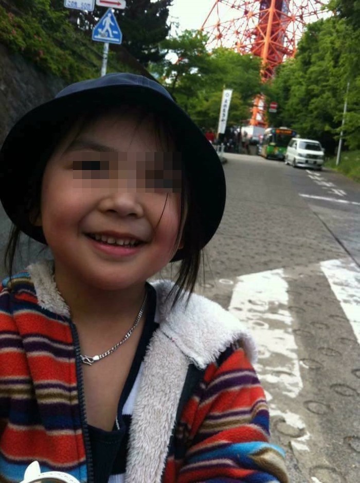 
Hình ảnh bé Nhật Linh khiến nhiều người không khỏi xót xa. (Ảnh: FBNV)