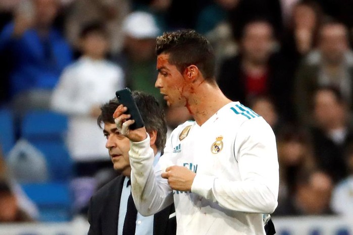 
Hai tuần trước, sau khi lập cú đúp vào lưới Deportivo tại vòng 20 La Liga 2017/18, Ronaldo đã vô tình bị va chạm đổ máu. Thay vì ăn mừng như mọi khi, chân sút hàng đầu Real Madrid chỉ biết nằm sân và chờ đợi sự giúp sức từ các bác sĩ. Sau vài phút kiểm tra, CR7 được cho rời sân vì vết thương khiến anh không thể thi đấu tiếp. Tình huống thú vị xảy ra khi Ronaldo nhanh chóng mượn điện thoại của một nhân viên y tế để kiếm tra vết thương trong lúc được dìu ra bên ngoài. Hành động này đã mở ra một cuộc bàn luận thú vị giữa các fan bóng đã trên mạng xã hội Twitter. Cư dân mạng cho rằng đây là "cử chỉ thương hiệu" chỉ có thể duy nhất tìm thấy ở Cristiano Ronaldo.​