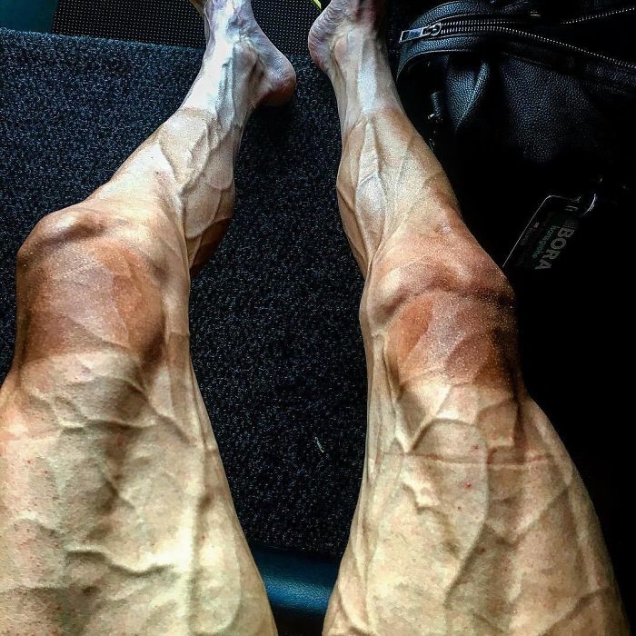 
Đây là chân của một người đàn ông sau khi tham gia giải đua xe đạp khắc nghiệt nhất hành tinh.
