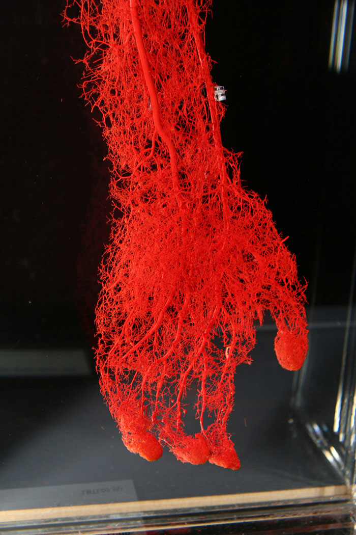 
Phải chăng đây là một loại rong rêu nào đó? Quan sát kĩ một chút xem nào! Nó chính là các mạch máu của một cánh tay con người đấy!