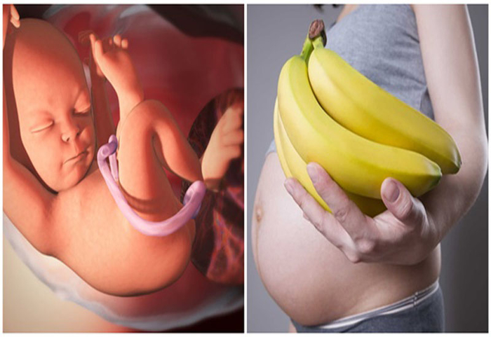 Mẹ bầu ăn 20 quả chuối mỗi ngày trong suốt thai kì, kết quả thu được khiến nhiều người bất ngờ