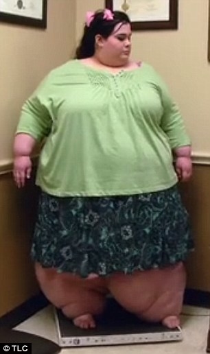 
Cân nặng của cô gái đã chạm mức 300 kg và khiến cho cô không thể tự thực hiện những hoạt động sinh hoạt hàng ngày