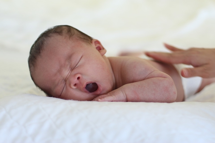 
Thóp của trẻ đóng quá sớm hoặc quá muộn đều là biểu hiện của bệnh lí