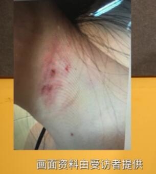 
Hình ảnh do Mã Dung cung cấp để chứng minh Vương Bảo Cường có hành động bạo lực với cô.