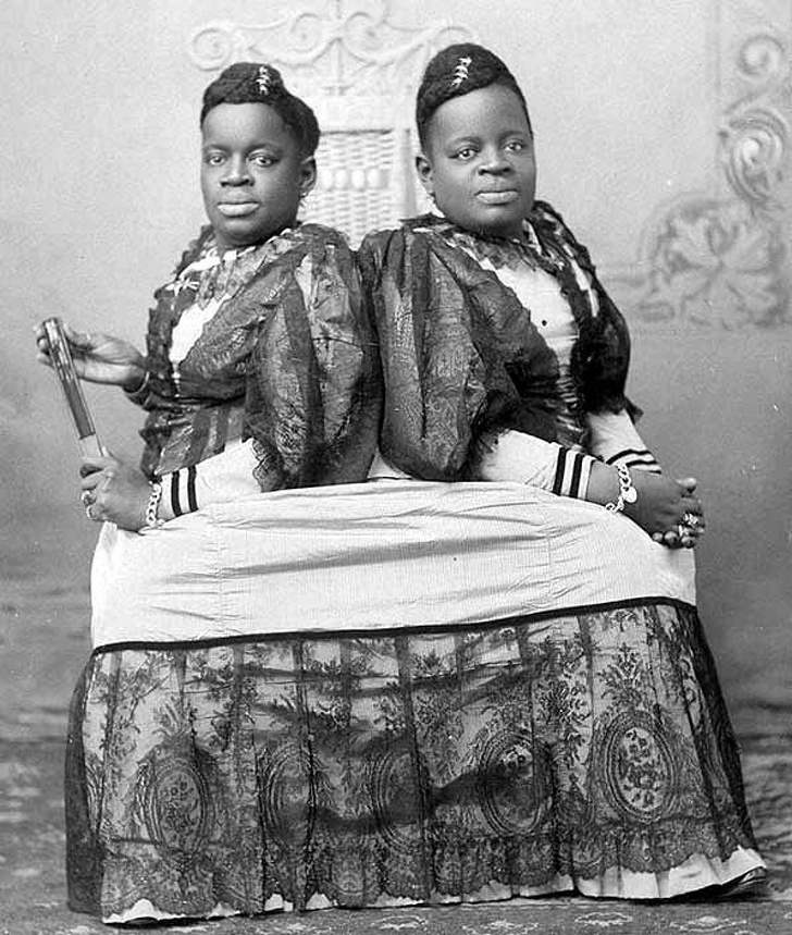 Sinh năm 1851 dưới thời nô lệ ở Bắc Carolina, Mỹ, cặp sinh đôi Millie và Christine McKoy bị dính liền hông này đã nhiều lần bị bán làm nô lệ cho đến khi một người đàn ông là chủ gánh xiếc đã nhận ra giá trị thương mại của họ và dạy dỗ cặp đôi này biểu diễn. Cả hai đều có khiếu đàn, hát và được mệnh danh là "sơn ca 2 đầu". 
