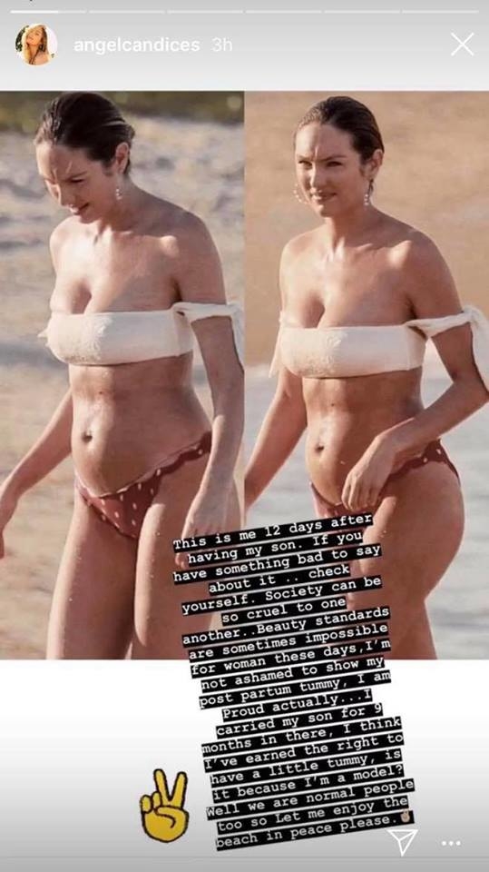 
Gần đây nhất, Candice Swanepoel xuất hiện trong bộ bikini vô cùng "đốt mắt" với một dáng vóc không quá tệ với một phụ nữ sau khi sinh. Nhưng lại dễ dàng trở thành cái cớ để các anti-fan chỉ trích. Tuy nhiên, không chỉ phớt lờ, nàng siêu mẫu có ngay bài đáp trả vô cùng đanh thép.
