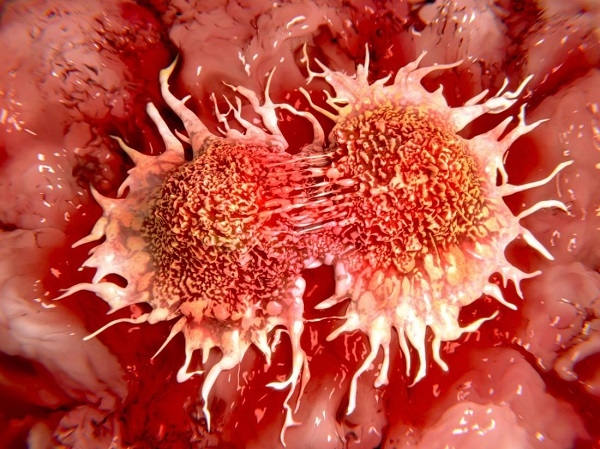 Phát hiện gây chấn động của Mỹ: Tế bào ung thư sợ nhất chính là tình yêu
