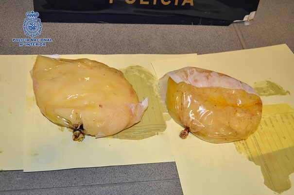 
Cocaine giấu trong túi nâng ngực của một phụ nữ người Colombia.