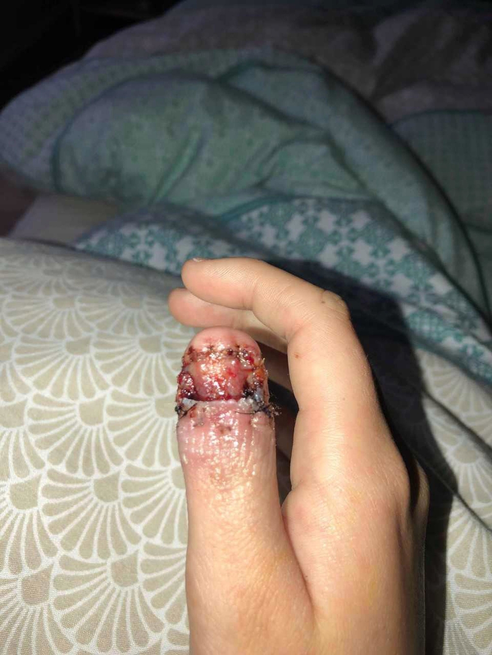 
Ngón tay cái khủng khiếp của Courtney