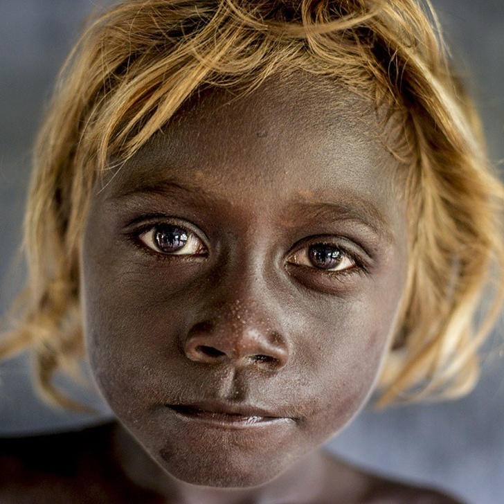 
Ở đảo Solomon, chỉ 10% dân số có da màu đen và tóc màu vàng