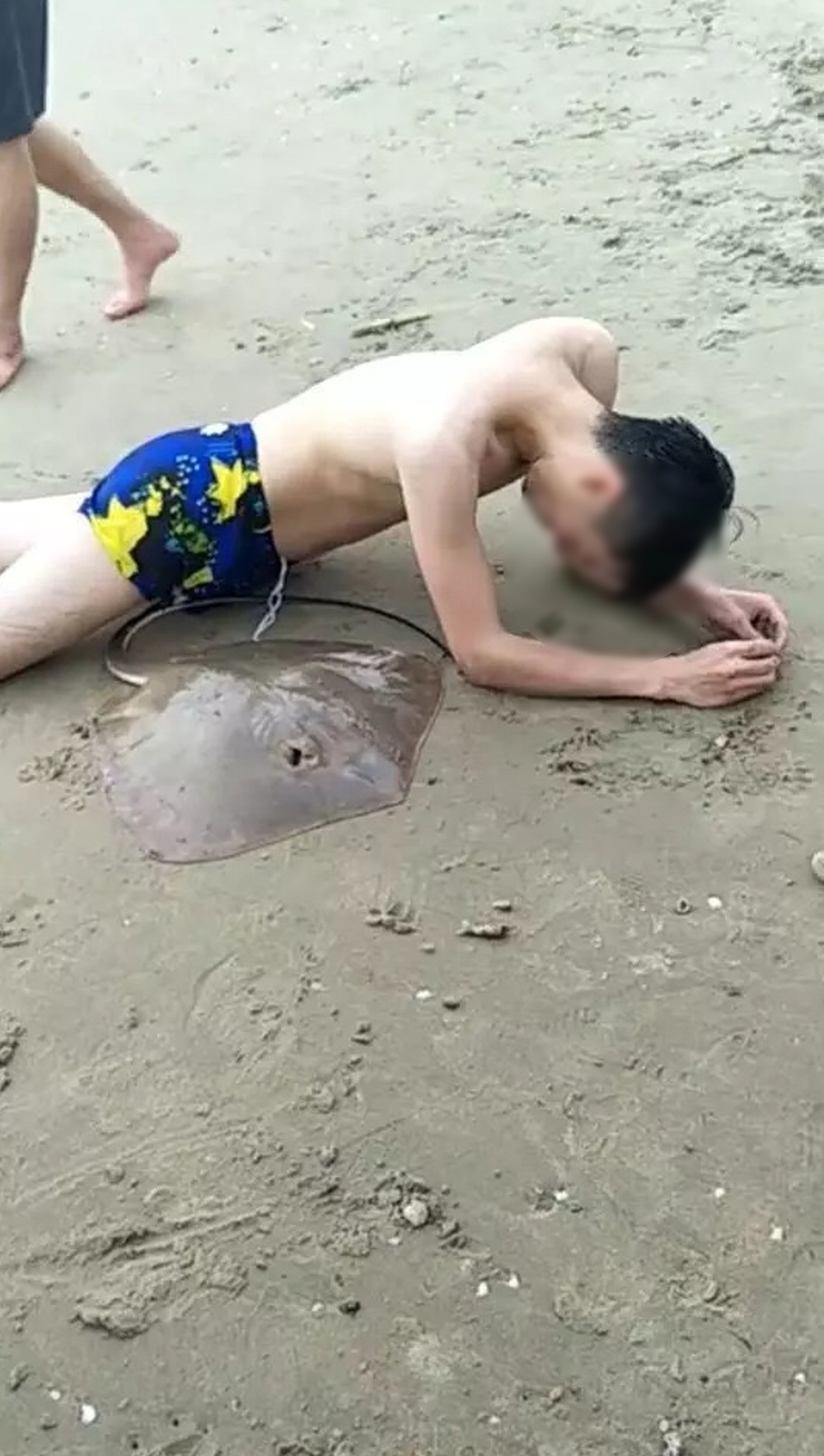 
Người đàn ông đau đớn trên bãi biển và con cá đuối nằm bên cạnh