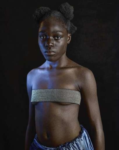 
Một bé gái tại Cameroon là nạn nhân của hủ tục là ngực