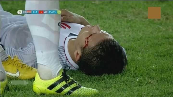 
Quang Hải luôn cống hiến hết mình trên sân cỏ. Hình ảnh anh đổ máu trong trận đấu gặp Syria khiến người hâm mộ vô cùng xót xa.